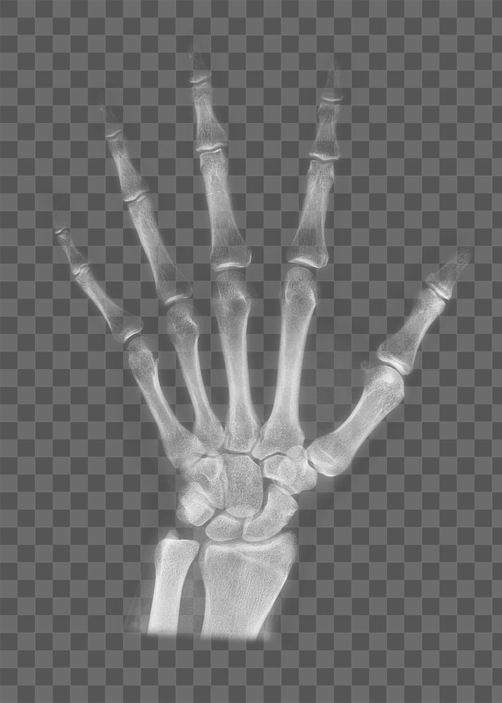 Hand CT scan png sticker, transparent background