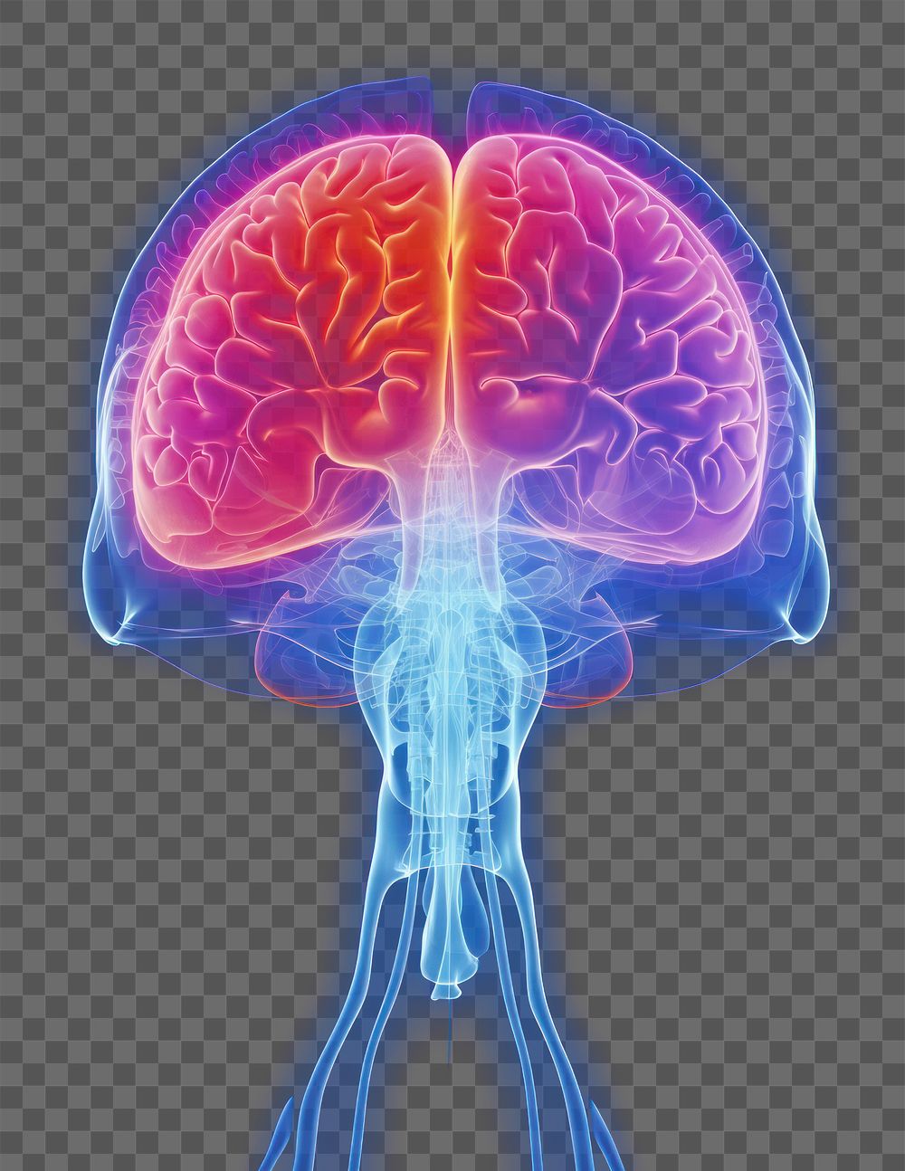 PNG Headach brain-xray colorful invertebrate neuroscience.