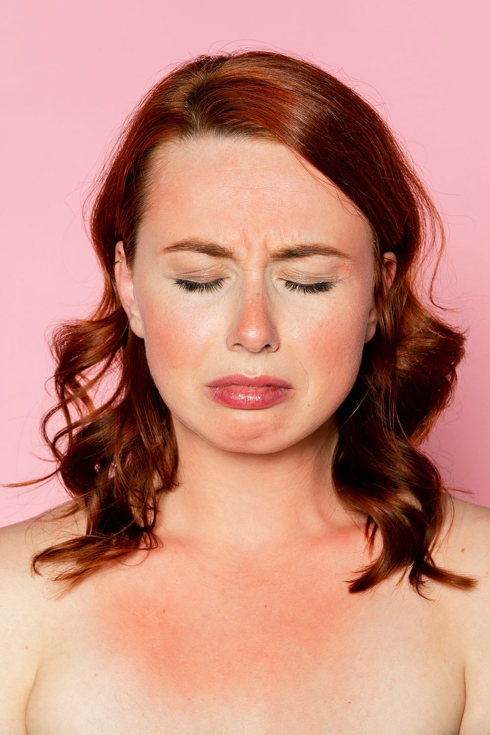 Sad Woman With Sunburnt Skin Premium Photo Rawpixel