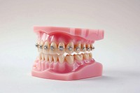 Plastic human braces teeth models dessert person mouth.