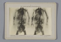 Röntgenopname van de aorta en de vertakkingen naar andere bloedvaten (1917) by Otto Hildebrand, Wilhelm Scholz, Julius Menno Wieting Pascha and Joseph Friedrich Bergmann