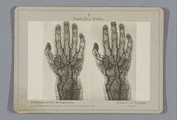 Röntgenopname van bloedvaten in een kinderhand (1917) by Otto Hildebrand, Wilhelm Scholz, Julius Menno Wieting Pascha and Joseph Friedrich Bergmann