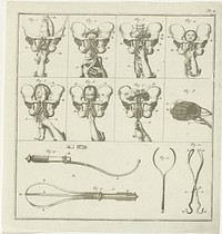 Gynaecologische voorstellingen (1730 - 1791) by Nicolaas van Frankendaal and C Plevier