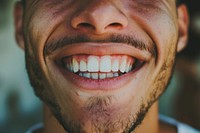 Man smiling teeth laughing adult.