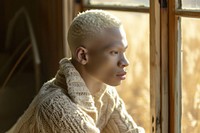Half albino african male portrait sweater contemplation.