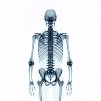 X-ray white background fracture skeleton.