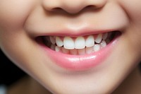 Smiling lips of kid teeth smile skin.
