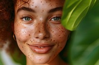Happy multiracial young woman with a face full of acnes skin hairstyle happiness.