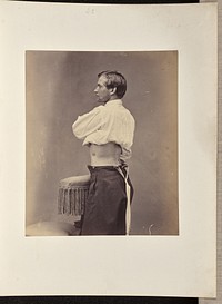 Recovery after Penetrating Gunshot Wound of the Abdomen, with Faecal Fistula by William H Bell
