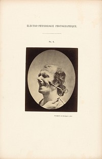 Électro-Physiologie Photographique, Figure 6 by Guillaume Benjamin Duchenne and Adrien Alban Tournachon
