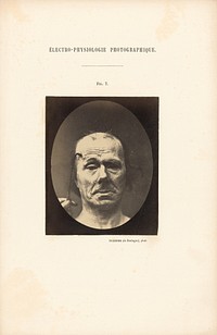 Électro-Physiologie Photographique, Figure 7 by Guillaume Benjamin Duchenne and Adrien Alban Tournachon