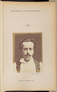 Fig. 15 by Guillaume Benjamin Duchenne and Adrien Alban Tournachon