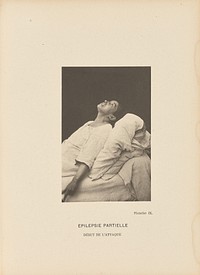 Épilepsie Partielle Début de l'Attaque by Paul Marie Léon Regnard