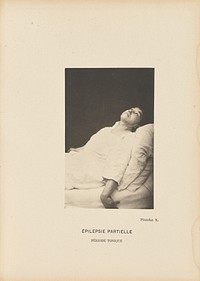 Épilepsie Partielle Période Tonique by Paul Marie Léon Regnard