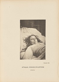 Attaque; Période Épileptoïde Stertor by Paul Marie Léon Regnard