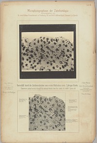 Dentinal tubules. Transverse ground section by Dr Alfred Gysi