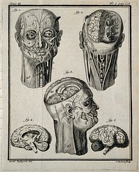 Wax models of the head and neck (figs 1-3), and of the right hemisphere of the brain (figs 4-5), made by G. G. Zumbo. Engraving by J. Robert after M. Basseporte, 1749.