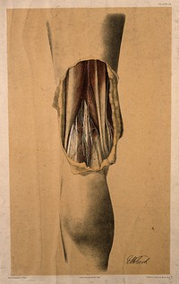 Dissection of the back of the leg, showing the muscles, tendons and blood vessels of the back of the thigh and knee joint. Colour lithograph by G.H. Ford, 1867.