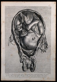 Dissection of a pregnant uterus, showing the foetus at nine months, with the head positioned towards the vagina and the lower part of the placenta under the child's head, detached from the uterus. Copperplate engraving by J. Mitchel after I.V. Rymsdyk, 1774, reprinted 1851.