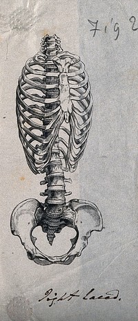 Bones of the ribcage and pelvis: two figures, showing the appearance of the ribcage and spine in both its natural state, and when distorted by tight lacing. Etching with watercolour, 1864.