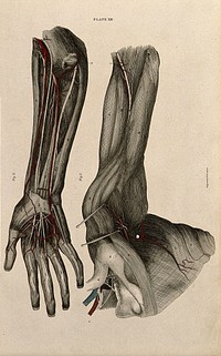 Arm and shoulder: two figures of a dissection, with blood vessels and nerves indicated in red and blue. Coloured line engraving by W.H. Lizars, 1822/1826.