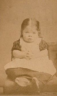 A very young girl, showing signs of mental deficiency, seated with her hands clasped upon her lap. Photograph by W. Moscrop.