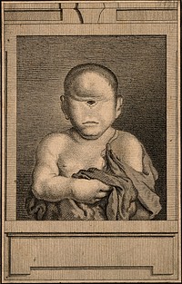 An infant with one central eye. Engraving.
