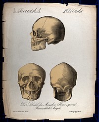 Skull of a human classified as 'Mongol': three figures. Chromolithograph, 1877.