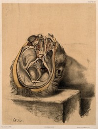 Dissection of the skull, showing the eyes with attached nerves and muscles. Colour lithograph by G.H. Ford, 1864.