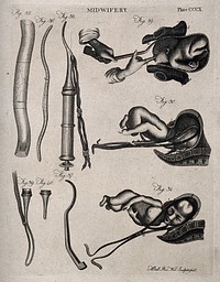 Nine diagrams illustrating breech and natural births and the obstetrical instruments used to assist them. Engraving by A. Bell.