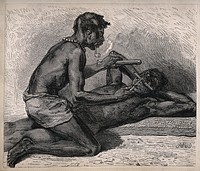 An African dentist performing an operation on a patient that he is restraining with a wooden stick. Wood engraving by MD.