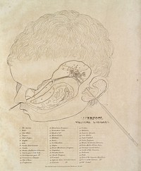 An engraved representation of the anatomy of the human ear. To which are added surgical remarks ... and a synoptic table of the diseases of the ear. Exhibiting in one view the external and internal parts of that organ in situ / [Thomas Buchanan].