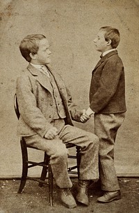 Down's syndrome: in two young men holding hands, one sitting and one standing. Photograph.