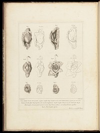 Anatomia uteri humani gravidi tabulis illustrata ... The anatomy of the human gravid uteris exhibited in figures / [William Hunter].