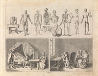 Anatomical figures (top); a physician takes the pulse of a sick man while the next two generations attend (bottom left); surgeons perform operations on a child and a woman. Etching by D. Berger, 1774, after D. Chodowiecki.