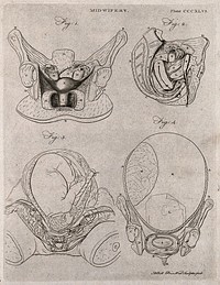 Four cross-sections of figures of the pregnant uterus. Engraving by A. Bell.