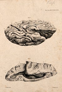 Brain of an African Bushwoman: two figures, each of a section of the brain. Lithograph by E.M. Williams after H. Watkins, 1864.