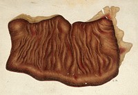Yellow fever: section of the large intestine of a patient infected with yellow fever. Watercolour, 1900/1930 .