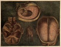 Dissections of the brain and blood vessels: three figures. Colour mezzotint by J.F. Gautier d'Agoty, 1748.