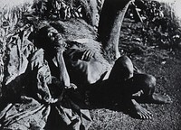 An inhabitant of Buruma Island, Uganda, suffering from sleeping sickness. Photograph, 1965, after photograph 1902.