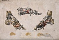 The foot: three diagrams showing the muscles, tendons and bones. Colour lithograph, ca. 1884.