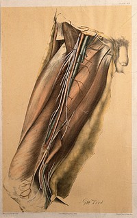 Dissection of the thigh of a man, showing the muscles, arteries, veins and blood vessels. Colour lithograph by G.H. Ford, 1866.