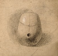 Skull, seen from above: Hole in sagittal suture. Pencil and chalk drawing by C. Landseer, or a contemporary, ca. 1815.
