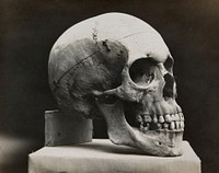 A skull prepared for demonstration: side view. Photograph.