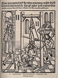 A male patient is hanging by his feet from an apparatus, a large worm  is passing from his mouth into a bowl, assisted by a surgeon and two assistants. Process print after a woodcut, 1497.
