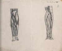 Muscles of the arm []: two figures. Pencil drawing by J. Mongrédien, ca. 1880.