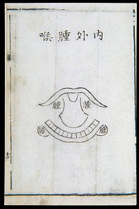 C18 Chinese woodcut: Inflammation of the throat