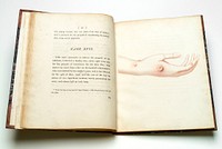 An inquiry into the causes and effects of the variolae vaccinae : a disease discovered in some of the western counties of England, particularly Gloucestershire, and known by the name of the cow pox / By Edward Jenner.