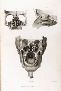 Anatomico-chirurgical views of the nose, mouth, larynx, & fauces / with appropriate explanations, and references ... The engravings executed by J. Hopwood, from original drawings, by T. Baxter. By John James Watt. [Together with an additional anatomical description of the parts, by Mr W. Lawrence.].