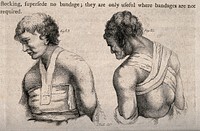 The upper body and head and ways of bandaging them. Stipple engraving by J. Bell.